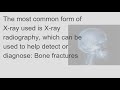 What is X-ray, usage and side effects