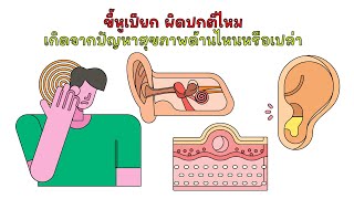 ขี้หูเปียก ผิดปกติไหม เกิดจากปัญหาสุขภาพด้านไหนหรือเปล่า