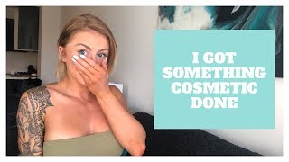 I GOT SOMETHING COSMETIC DONE | My Experience
