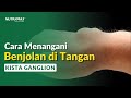 Bagaimana Cara Menangani Benjolan di Pergelangan Tangan? Kista Ganglion