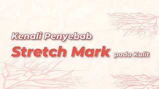 Apa yang Menyebabkan Stretch Mark pada Kulit?