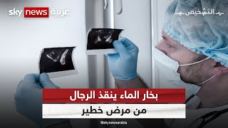 تقنية الريزوم لعلاج تضخم غدة البروستات | #برنامج_التشخيص