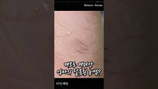 망친 눈썹? #반영구 #반영구아카데미 #청담그레이스 #pmu #kbeauty #색소제거