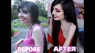 Eugenia Cooney (Before & After)