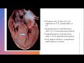 Hypertrophic Cardiomyopathy and Pregnancy