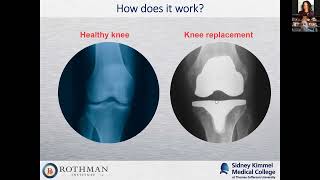 Home Sweet Home: Outpatient Hip and Knee Replacement – A Lecture from Dr. Saxena
