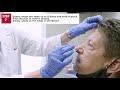 cultura™ testing procedure how to collect a nasopharyngeal swab specimen