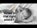 Heart murmurs in children - what to think?