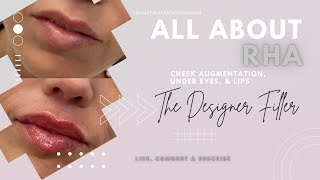 RHA | The Designer Filler | Lip Filler | Under Eye Filler | Cheek Filler