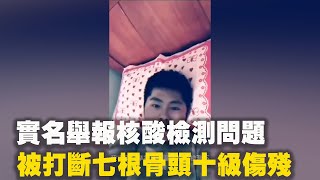 國家基因庫江蘇中心主任王德明實名舉報華大基因核酸檢測問題，被華大打斷七根骨頭十級傷殘| #大紀元新聞網