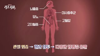 허리 디스크까지? 다양한 합병증을 유발하는 '관절 염증' | 한 번 더 리즈시절 51회 | JTBC 230812 방송