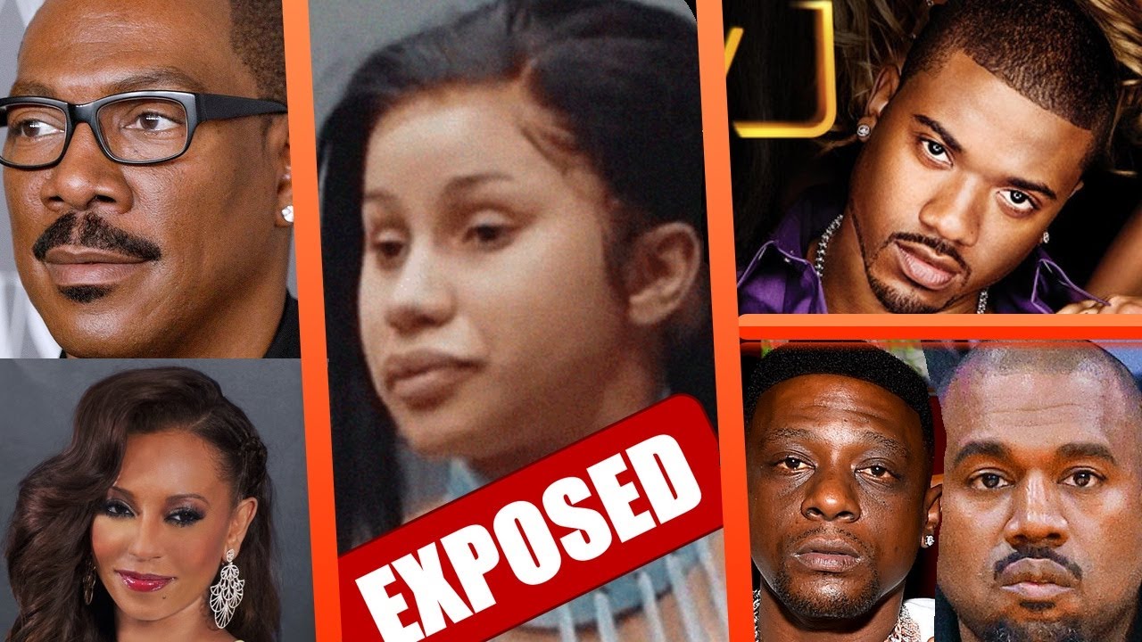 Cardi B Doctor REVEAL BBL Face Work, Eddie Murphy Pay $35K Child ...