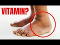 #1 Vitamin to Eliminate Swelling in Feet and Legs