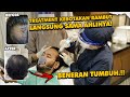 3 PENYEBAB RAMBUT KEBOTAKAN DINI DAN CARA MELEBATKAN RAMBUT TIPIS