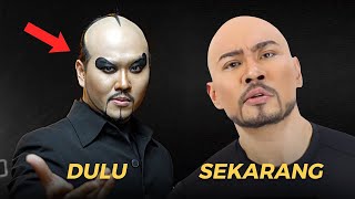 TERUNGKAP PENYEBAB DEDDY CORBUZIER JADI BOTAK