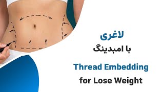 لاغری با کاشت نخ یا امبدینگ ---Losing weight with catgut embedding