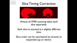 12. FMRI1: Preprocessing (Fmri1 E2)