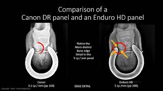 Image Quality in Digital Radiography