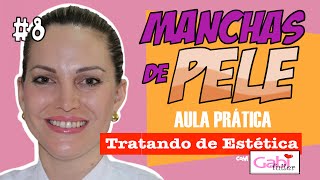 Manchas de Pele - Aula Prática