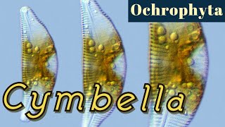 Cymbella (Bacillariophyceae = Diatom)