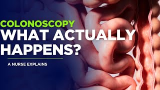 What Actually Happens During a Colonoscopy? A Nurse Explains (No Scary Stuff)