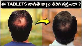 #AskDrJohnWatts | ఈ TABLETS వాడితే జుట్టు తిరిగి వస్తుందా ? | Hair Specialist Explains