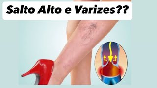 SALTO ALTO AGRAVA VARIZES: MlT0 OU VERD4DE?