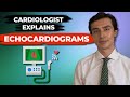 Cardiologist explains Echocardiograms