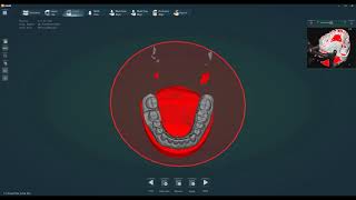 UP3D SCANNERS -  Basic scan in EXOCAD