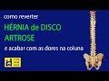 Como reverter hérnia de disco, artrose e acabar com as dores na coluna.