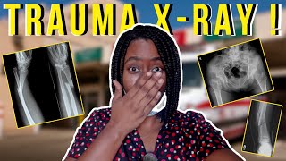 how to prepare for trauma patients in radiography ~ x-ray dept. || Ask The Rad Tech