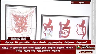 பிறந்து 10 நாட்களே ஆன பெண் குழந்தைக்கு அரிதான அறுவை! - மதுரை ப்ரீதி மருத்துவமனை சாதனை