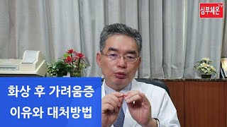 화상 후 가려움증의 이유와 대처 방법