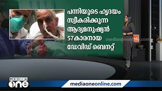 മനുഷ്യന് പന്നിയുടെ ഹൃദയം, ഗ്രാഫിക്കൽ സ്‌റ്റോറി കാണാം...