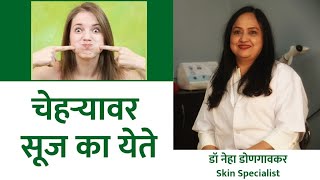 चेहऱ्यावर सूज का येते | चेहऱ्यावर सूज कशामुळे येते | चेहऱ्यावर सूज येण्याचे कारण