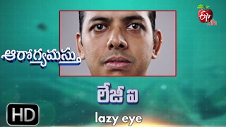 Aarogyamastu | Lazy Eye | 13th February 2017 | ఆరోగ్యమస్తు