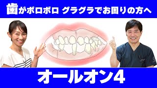 【オールオン４】歯を失った時の治療法について