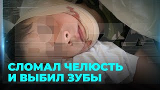 Полицейский на самокате сбил ребёнка