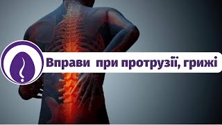 Як лікують грижу? Дієві вправи при грижі