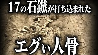 【ゆっくり解説 】17個も石鏃が打ち込まれた人骨！？兵庫県の弥生遺跡で