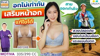 [Dream]แก้อกไม่เท่ากัน เสริมหน้าอก เภสัชกร สายสปอร์ต | Motiva 335 / 290 cc