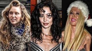 OZEMPIC Is DESTROYING These Celebs Bodies... they need help