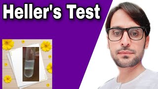 Heller's Test | Practical | For Detection of Urinary Protein