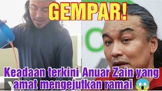 Mengejutkan! Keadaan terkini penyanyi Anuar Zain patutlah lama tak muncul 😱