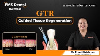 What is Guided Tissue Regeneration (GTR) ? | Periodontal Surgery with GTR | Dr Preethi Krishnan