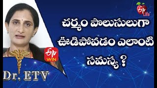 Ichthyosis - Causes | చర్మం పొలుసులుగా ఊడిపోవడం ఎలాంటి సమస్య ? | Dr.ETV | 3rd May 2021 | ETV Life