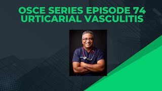 OSCE Series Episode 74 :  Urticarial Vasculitis