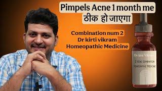 My 2nd Acne pimples Combination | Homeopathic Medicine | pimples or Acne ठीक करें ।