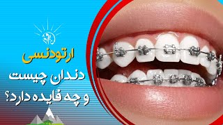 صبح فردا: سیم پیچی یا  ارتودنسی دندان چیست و چه فایده دارد؟