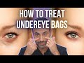 How to Treat Under Eye Bags | Dr. Ben Talei | Beverly Hills CA Plastic Surgeon